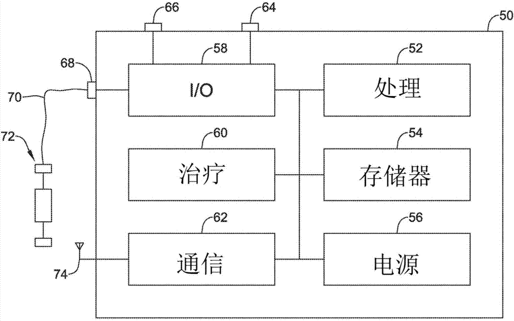 使用时间优化的医疗设备系统中的通信的制作方法与工艺