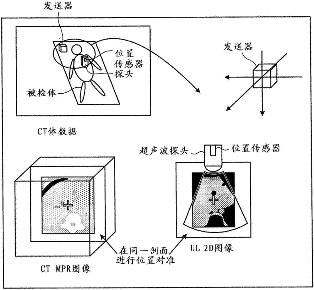 超声波诊断装置以及图像数据的校正方法与流程