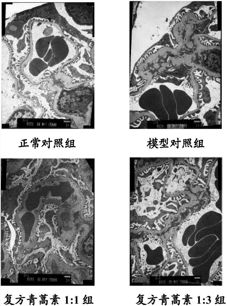 青蒿素和羟基氯喹联合用于治疗iga肾病的用途的制作