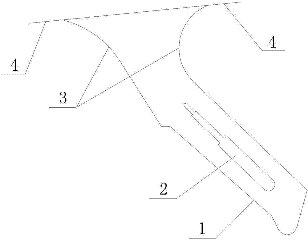 具有導(dǎo)引功能的上挑式手術(shù)刀片的制作方法與工藝