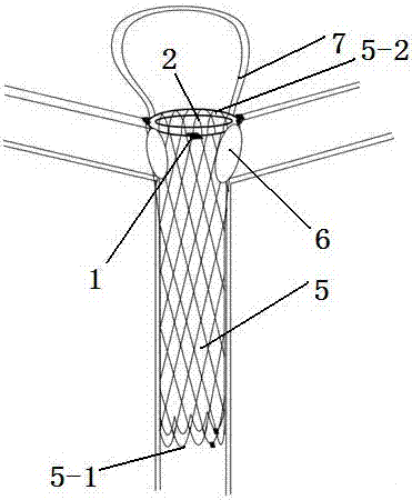 用于腦動(dòng)脈分叉處動(dòng)脈瘤的帶側(cè)孔的血管支架的制作方法與工藝