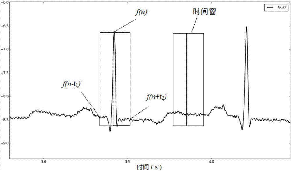 一種心電R波定位方法與流程