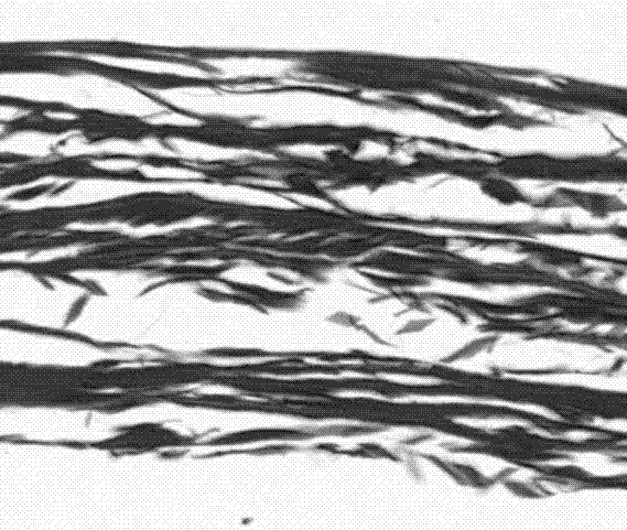 一種硬膜生物補(bǔ)片及其制備方法與流程