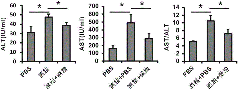 一種納米脂質(zhì)微泡的制備方法及應(yīng)用與流程