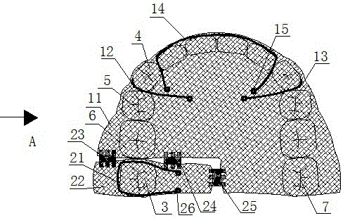 替牙期上頜牙合墊式磨牙遠(yuǎn)移器的制作方法與工藝