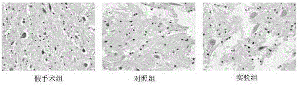 一种化合物在修复神经损伤中的应用的制作方法与工艺