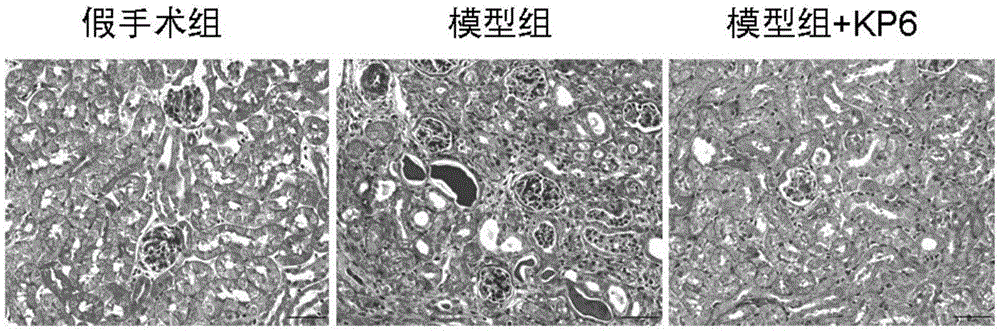 小分子多肽KP?6在制備治療慢性腎臟病的藥物中的用途的制作方法與工藝