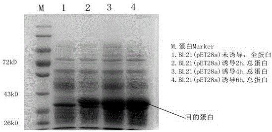 可降低血尿酸的短乳杆菌DM9218、基因片段及重组蛋白的制作方法与工艺