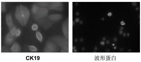 人羊膜上皮干細(xì)胞無血清培養(yǎng)基及其培養(yǎng)方法與流程