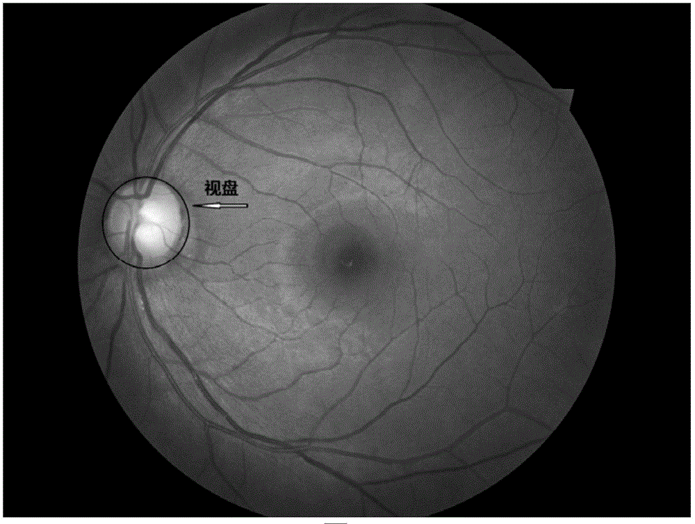 視網(wǎng)膜圖像分類方法及裝置與流程