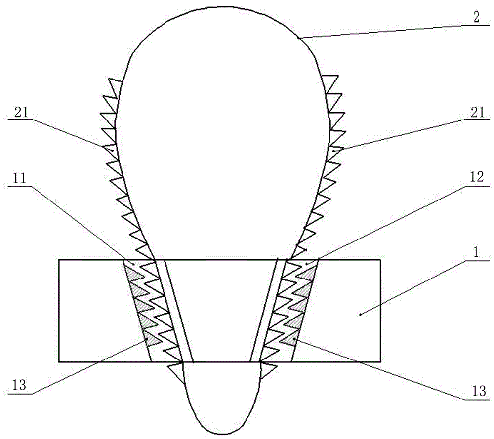 內鏡套扎環(huán)的制作方法與工藝