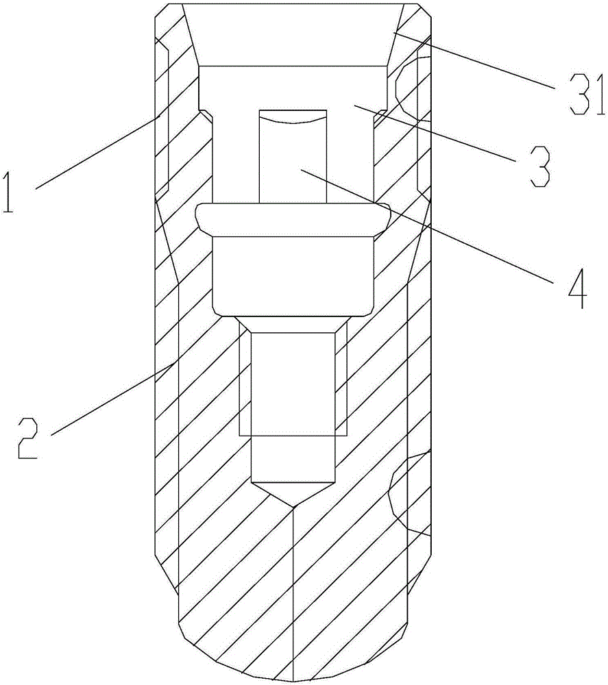 牙種植體的制作方法與工藝