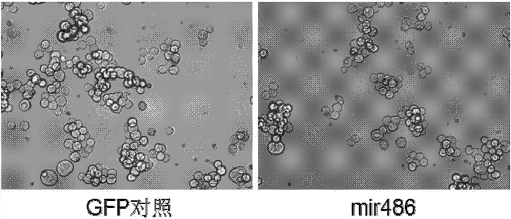 攜帶人miR486基因的重組腺病毒、制備該病毒的載體及應(yīng)用的制作方法與工藝