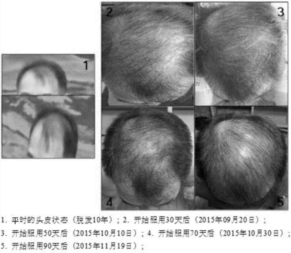 促進(jìn)生發(fā)、預(yù)防脫發(fā)和改善毛囊用食用蟋蟀組合物的制作方法與工藝