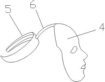 一种暗疮治疗仪的制作方法与工艺