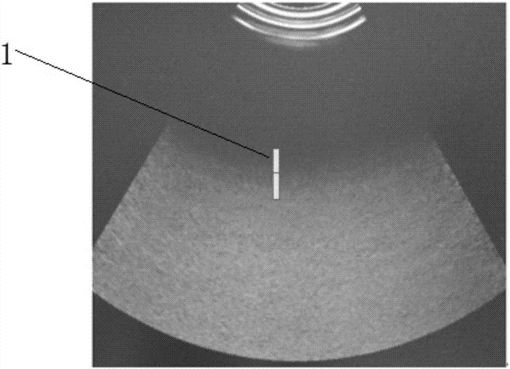 一種超聲診斷儀測量距離的方法與流程