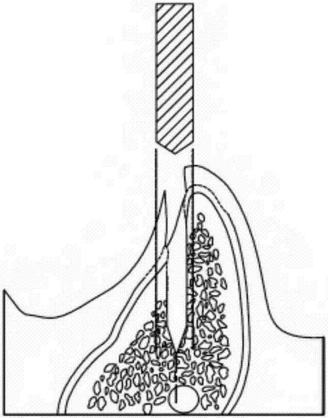 將人工牙根植入默認(rèn)位置的規(guī)劃導(dǎo)引方法與鉆孔導(dǎo)引裝置與流程