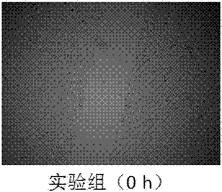 鹿茸多肽的应用、牙种植体及其表面处理方法与流程