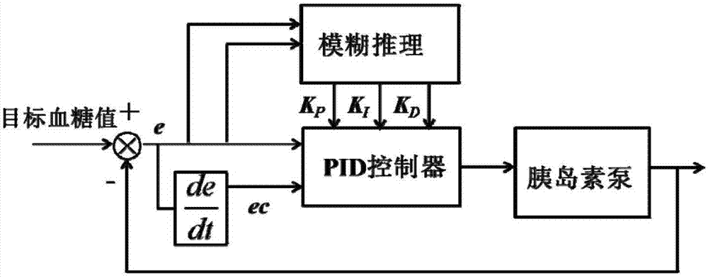 基于模糊自適應(yīng)比例微積分控制胰島素泵閉環(huán)輸注的方法與流程