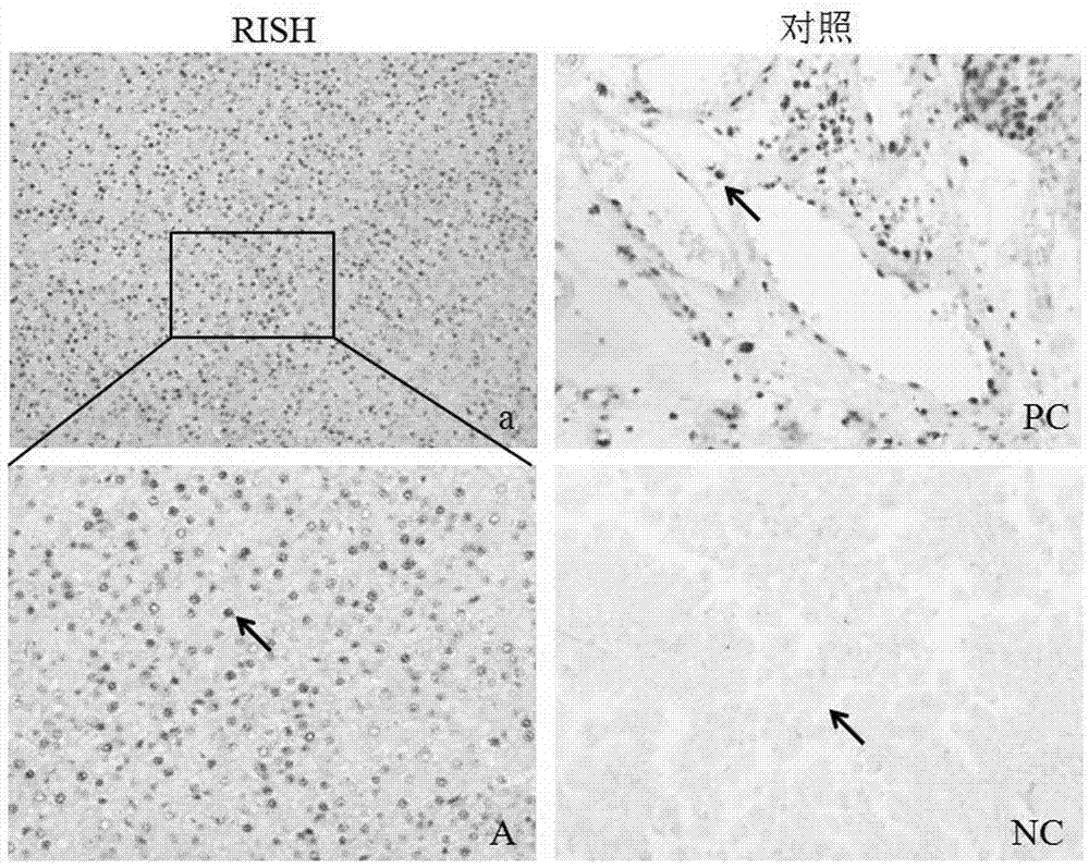 组织芯片的RNA-蛋白质-DNA原位多重染色方法与流程