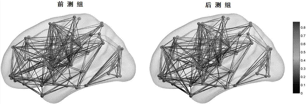 一種檢測養(yǎng)血清腦丸改善認(rèn)知功能的腦網(wǎng)絡(luò)分析方法與流程