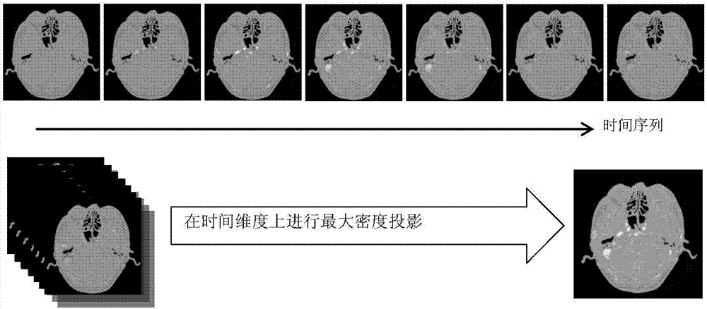 基于管狀特征增強濾波和脊線跟蹤的三維血管中軸線提取方法與流程