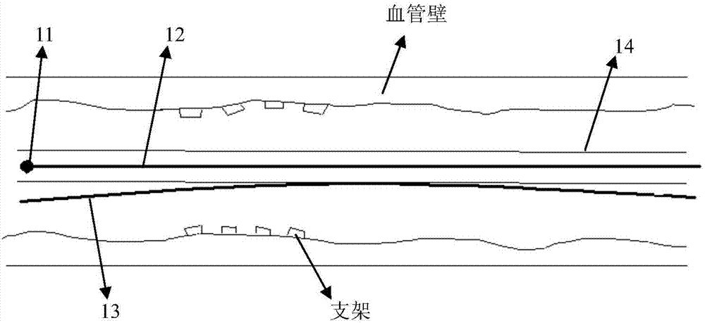 基于OCT影像的生物可降解支架的自動檢測的方法及裝置與流程