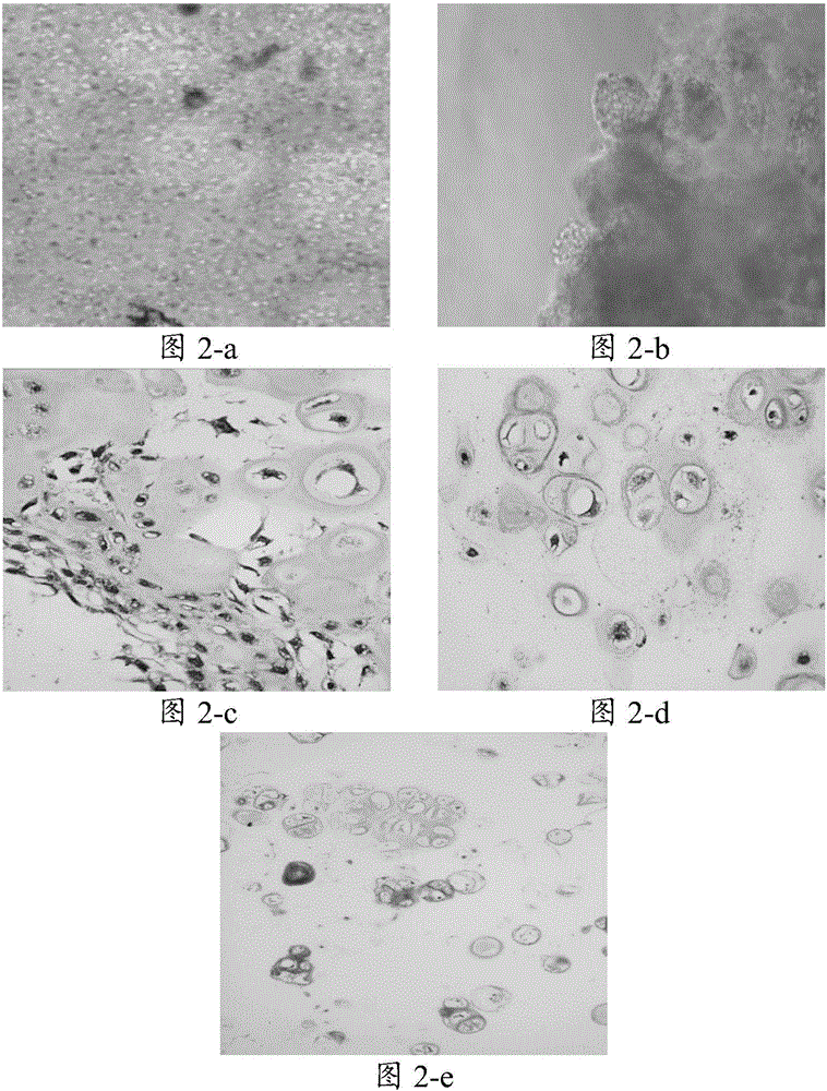 一种培养体系及其应用与培养软骨细胞的方法与流程