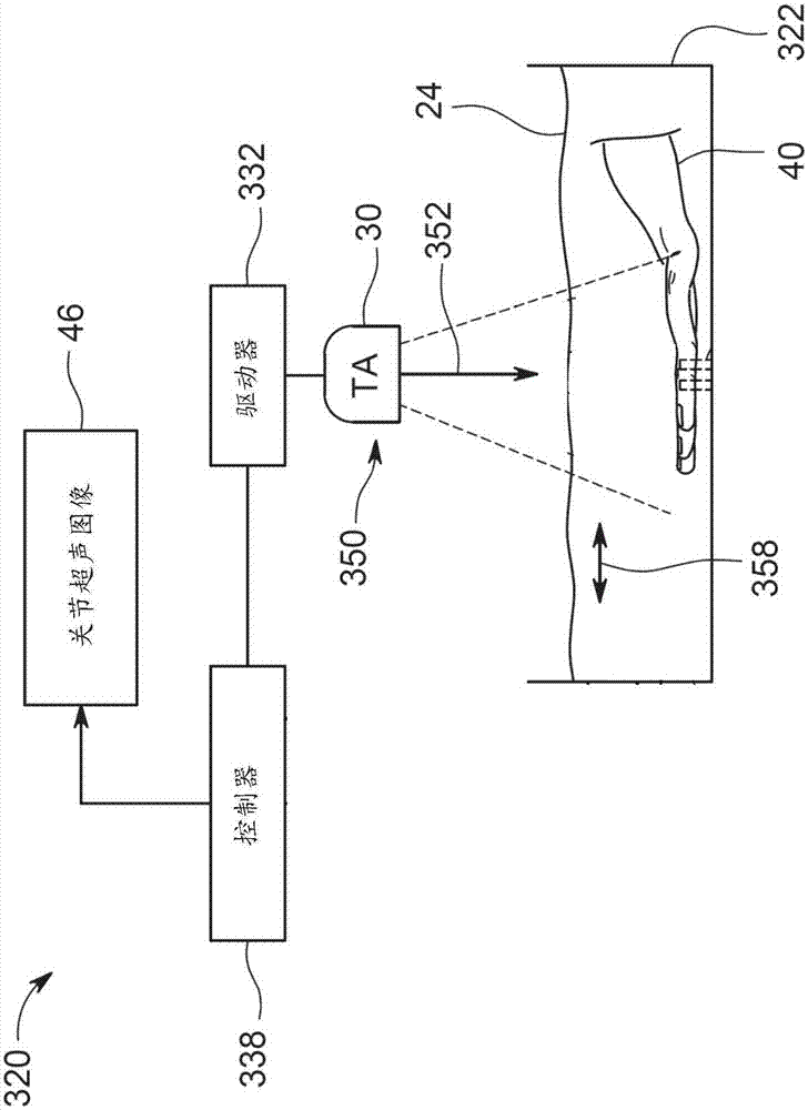 關(guān)節(jié)超聲成像系統(tǒng)及其方法與流程