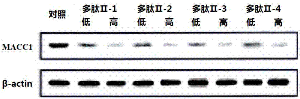 MACC1基因的多肽抑制劑及應(yīng)用的制作方法與工藝