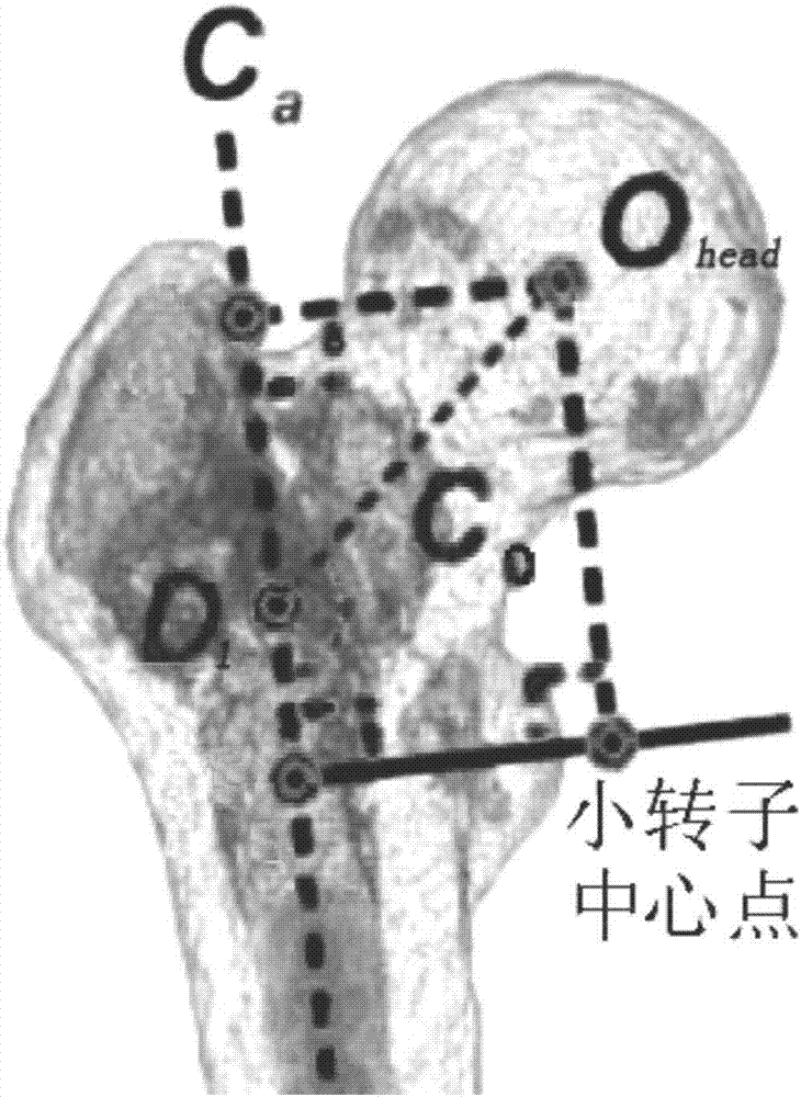 一种个体化股骨短柄的制作方法与工艺