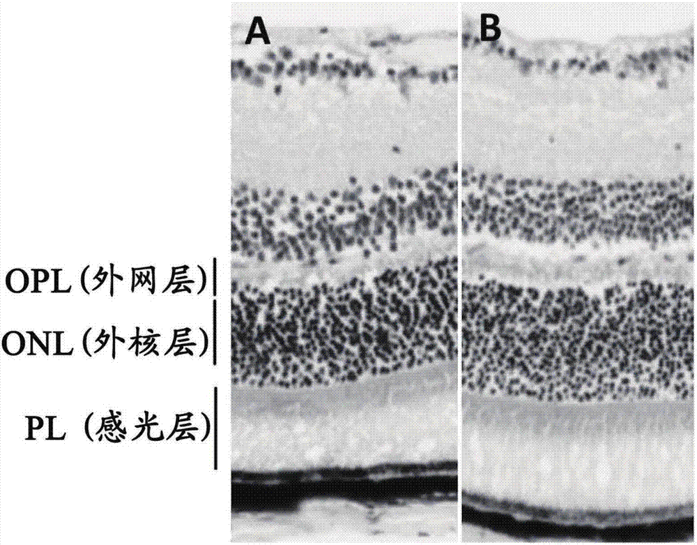 一種預(yù)防或治療糖尿病性視網(wǎng)膜病變的方法與流程