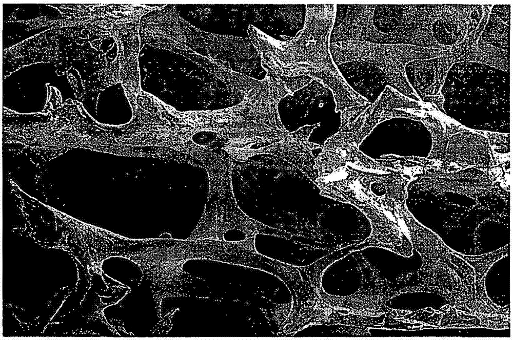 骨植入物基質(zhì)及其制備方法與流程