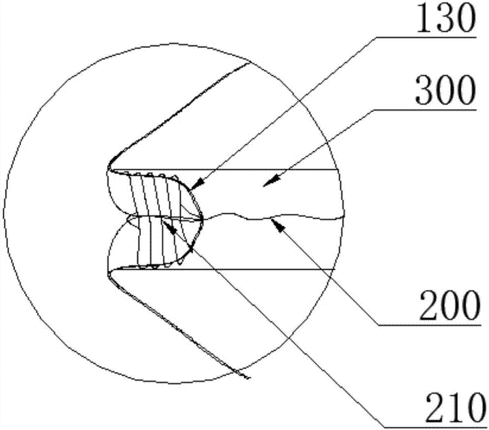 一種可取出囊袋和一種骨填充物推注系統(tǒng)的制作方法與工藝