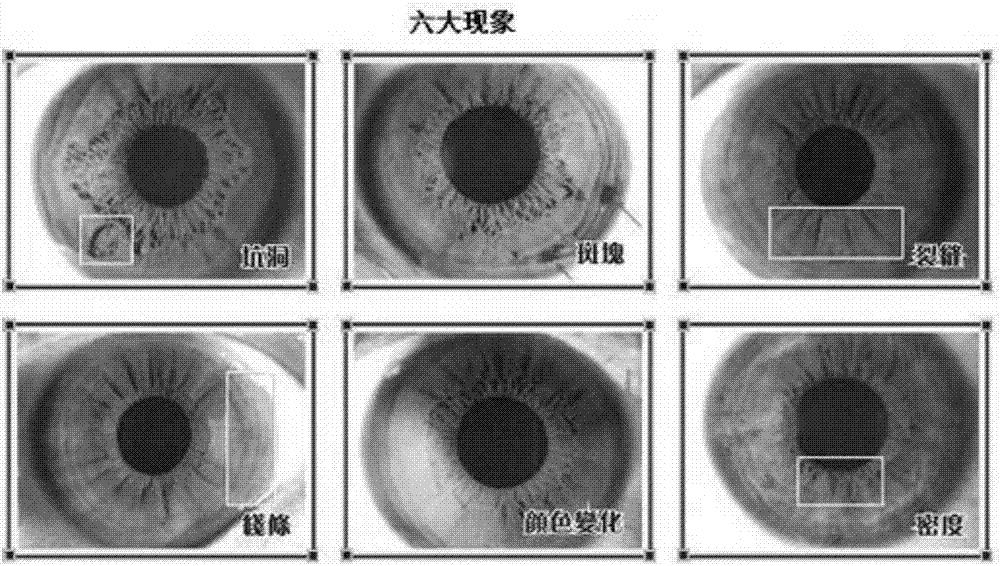 基于虹膜检测技术构建中学生精神压力检测系统的方法与流程