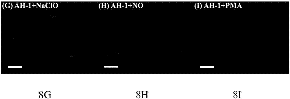 过氧亚硝酸根离子检测探针、制备方法及其应用与流程