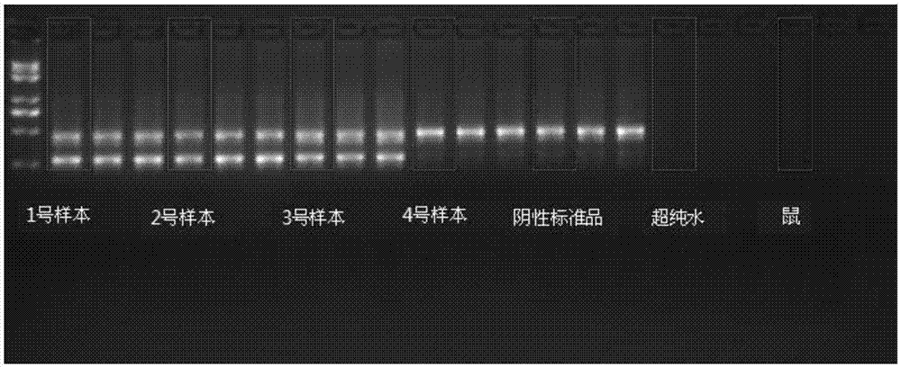 人JAK2V617F基因突变检测试剂盒的制作方法与工艺