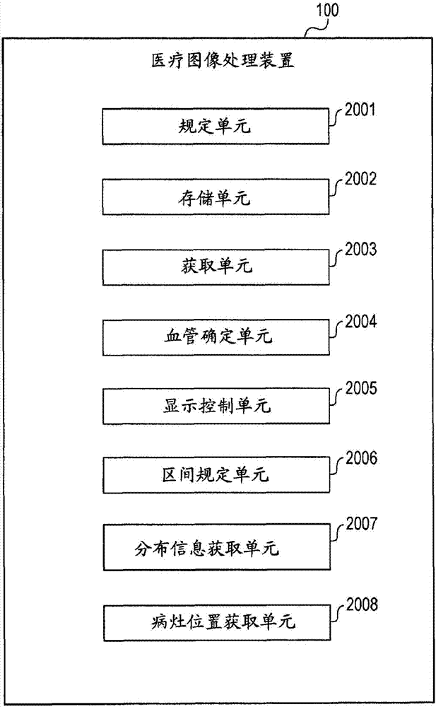 医疗图像处理装置、其控制方法和存储介质与流程