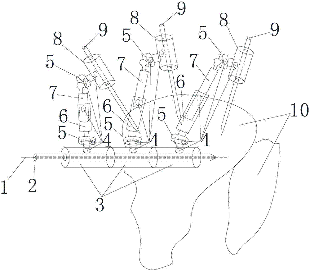 一種多軸三維螺釘定位導(dǎo)向器的制作方法與工藝