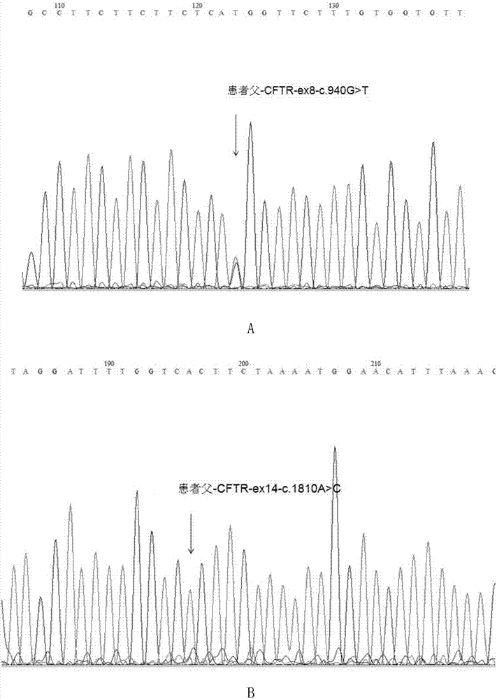 囊性纤维化患者的CFTR基因突变形式及其应用的制作方法与工艺