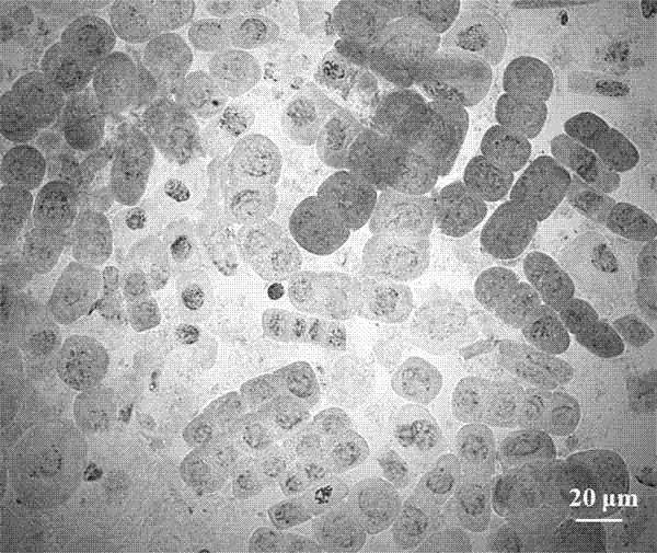 一种制备石刁柏根尖细胞染色体中期分裂相标本的方法与流程