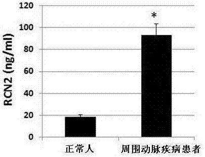 基于RCN2標志物檢測的心血管病檢測方法及試劑盒與流程