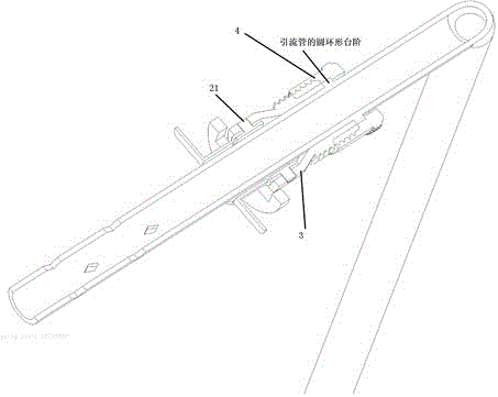 消化道支撐引流裝置的制作方法