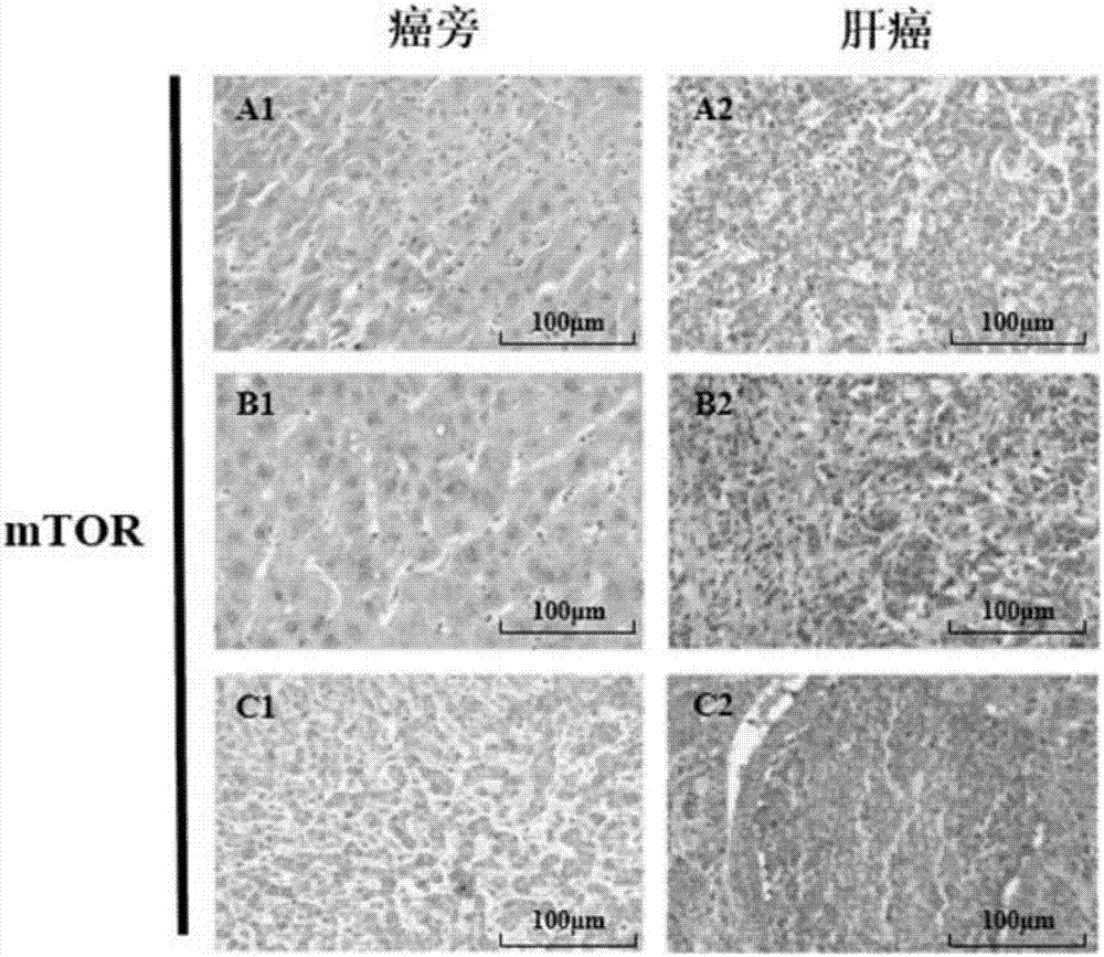 蛋白激酶mTOR的S2481位点磷酸化作为肿瘤用药的标志物的制作方法与工艺