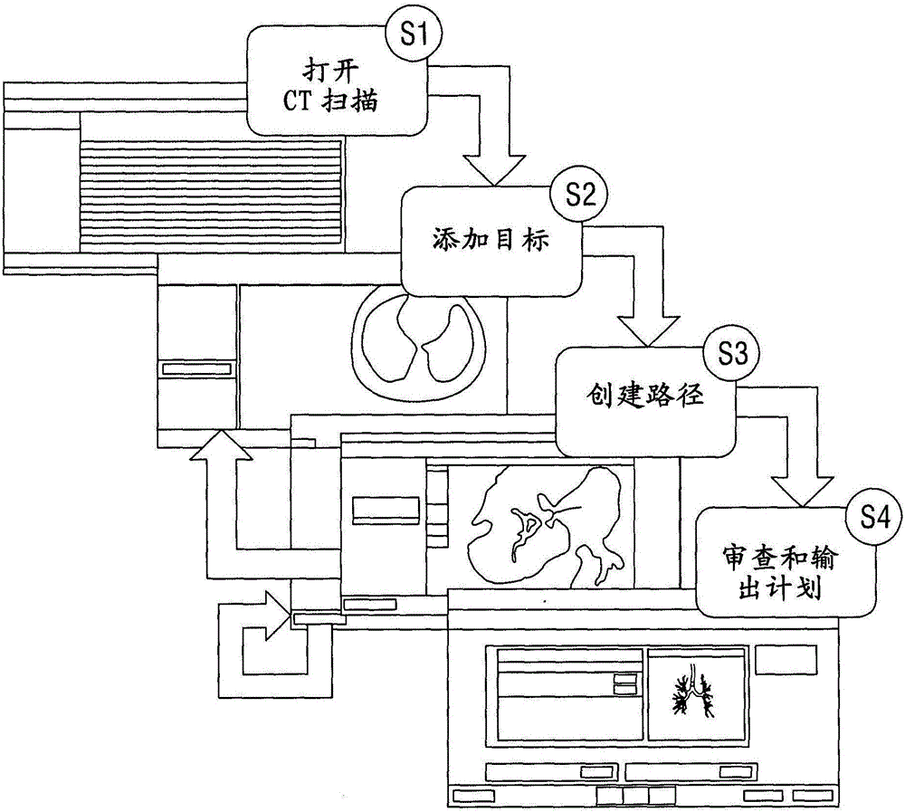 用于导航通过虚拟支气管镜视图中的气道的系统和方法