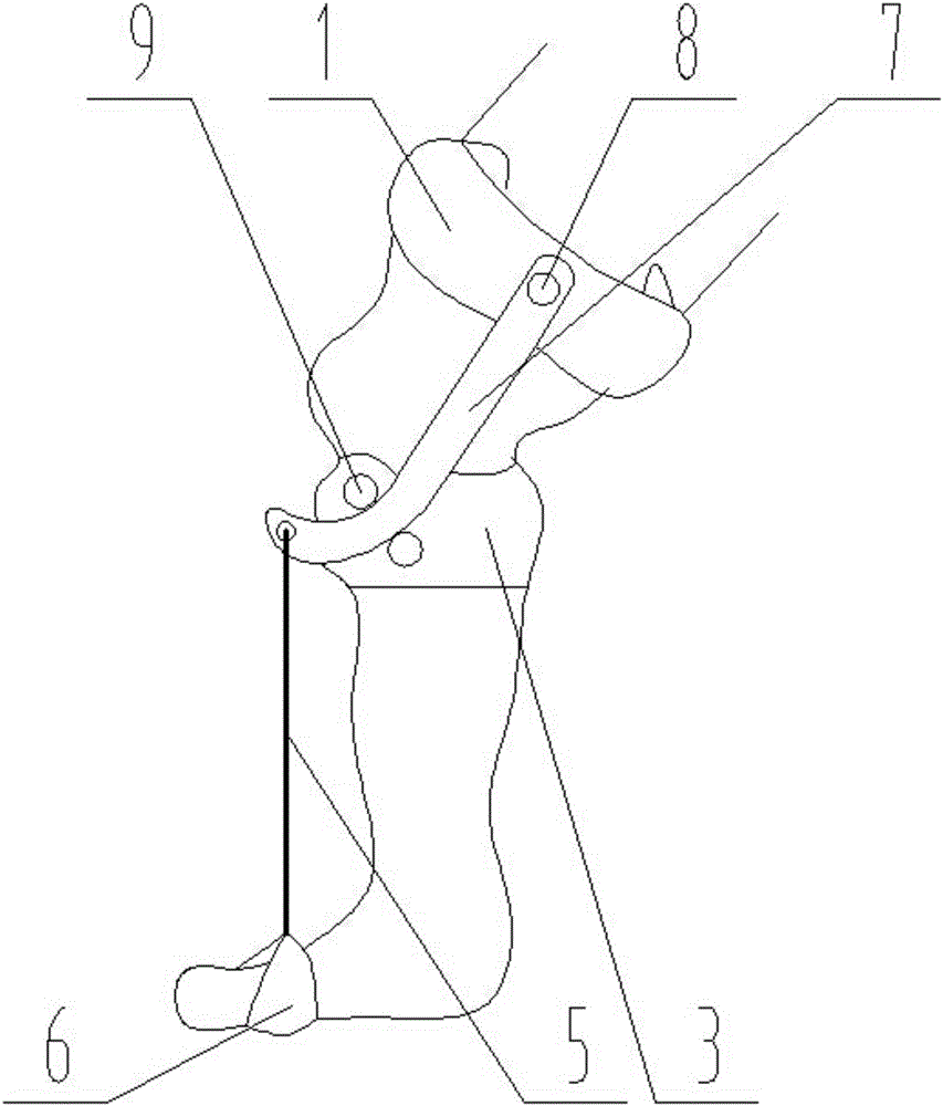 膝动力弧度滑轮式足下垂及偏瘫步态矫正器的制作方法与工艺
