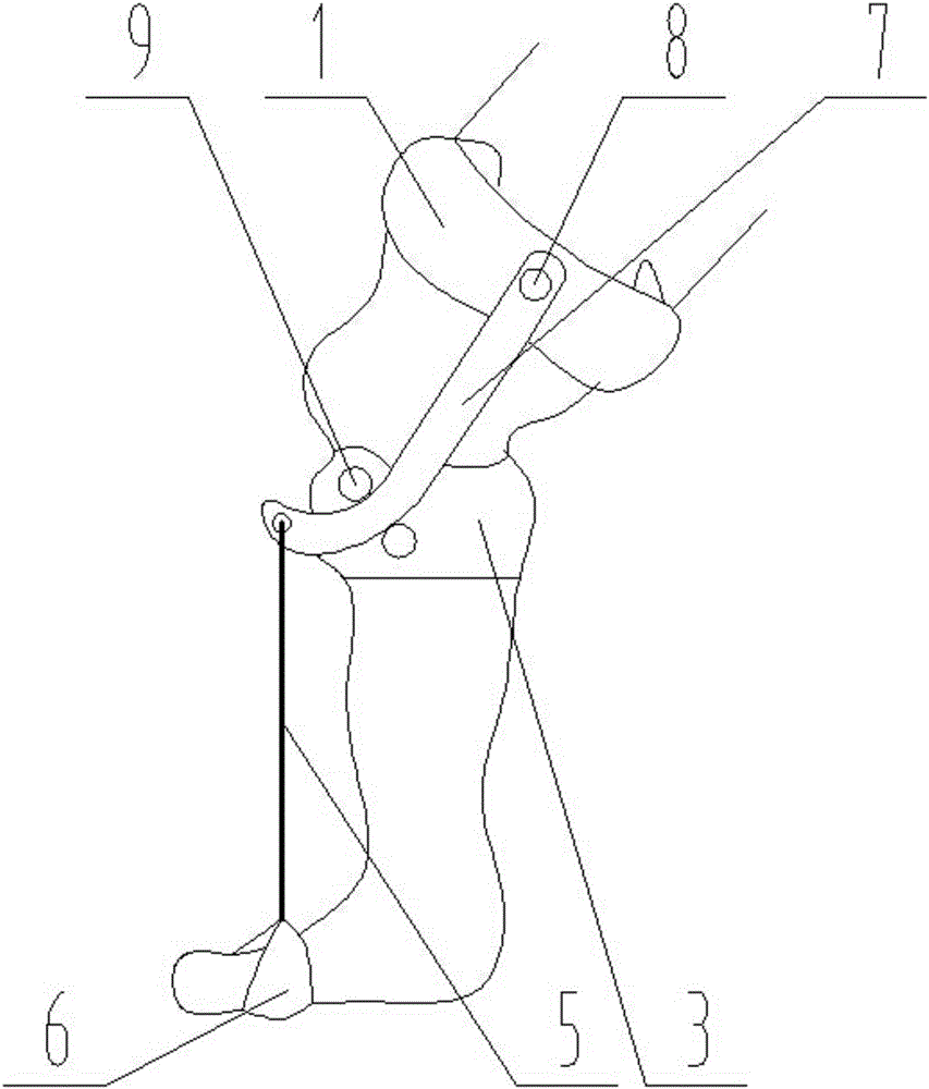 膝动力弧度滑轮式足下垂及偏瘫步态矫正器的制作方法