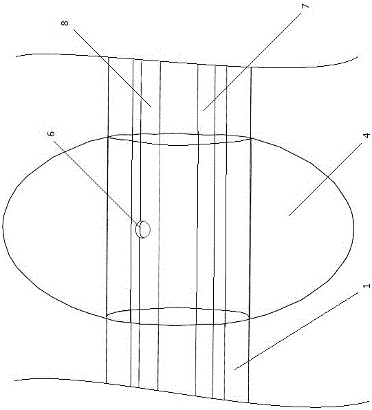 避孕宫吸受精卵吸出装置的制作方法