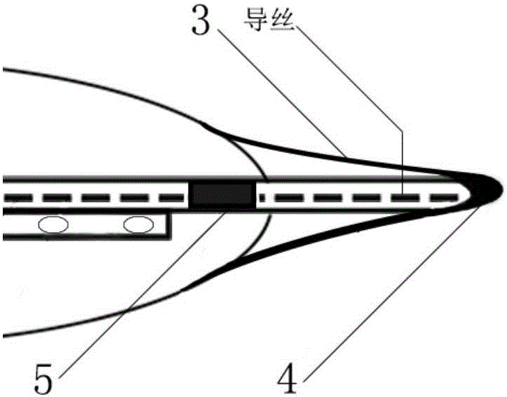 一種膽道鏡取石用球囊擴(kuò)張導(dǎo)管的制作方法與工藝