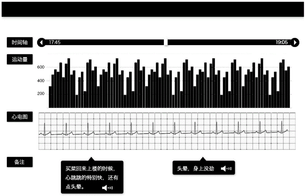 一種結(jié)合使用者運(yùn)動(dòng)量和感官主訴的心電圖診斷方法與流程